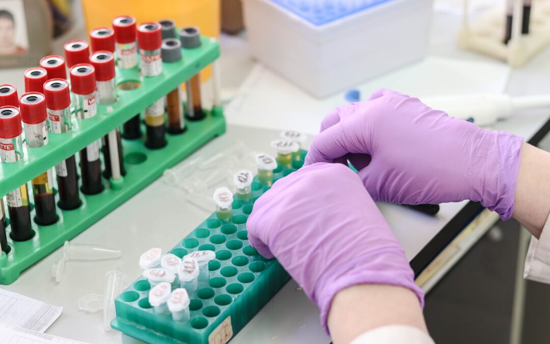 NEW BLOOD TEST DETECTS CANCER’S RETURN 1 YEAR EARLY