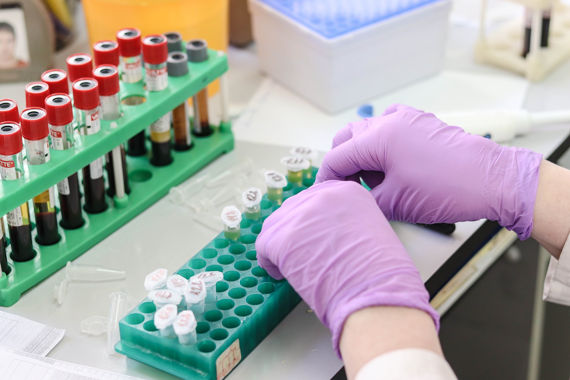 blood test to detect cancer - cyberknife miami - early detection of cancer