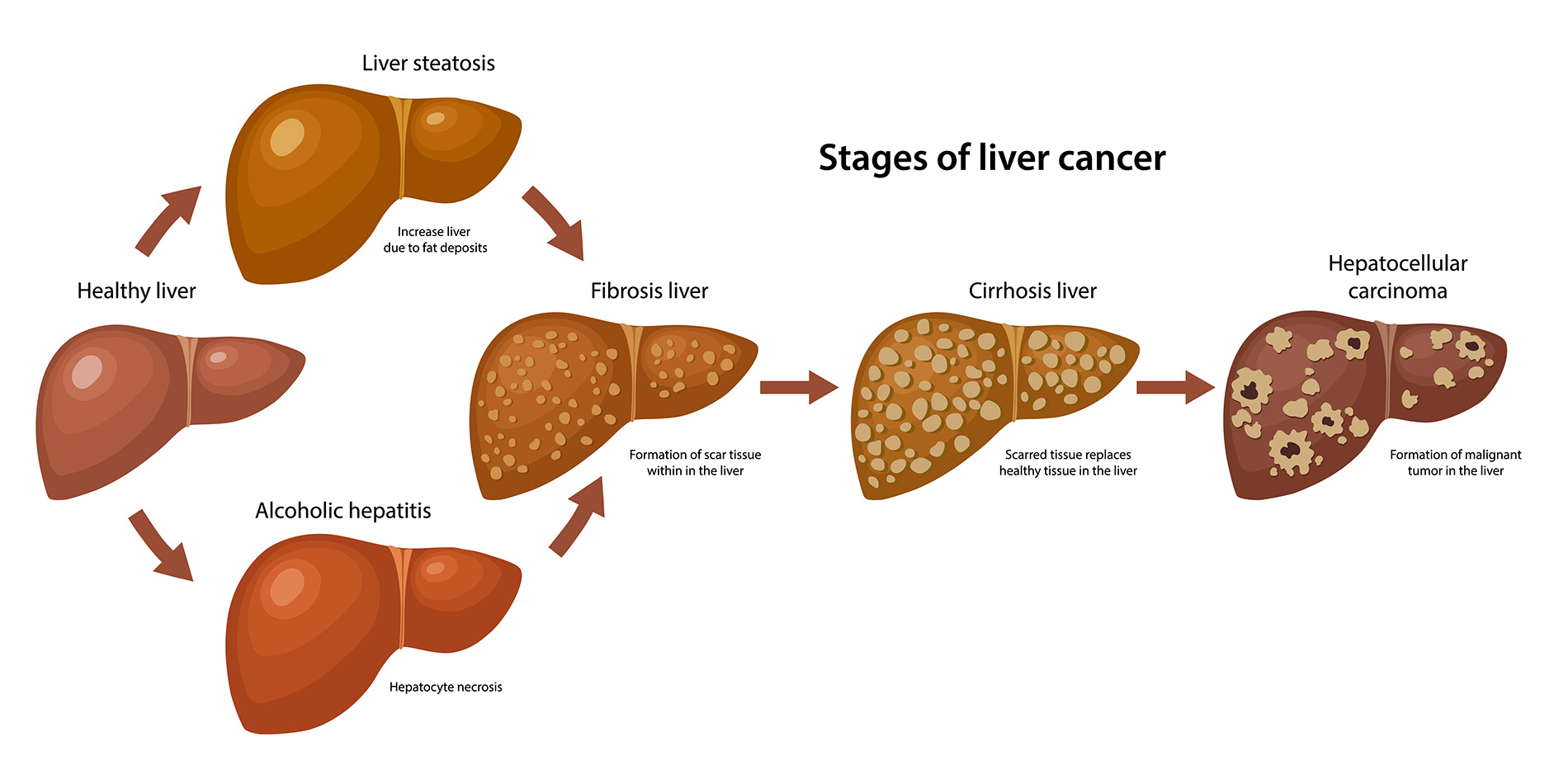 research article about liver cancer