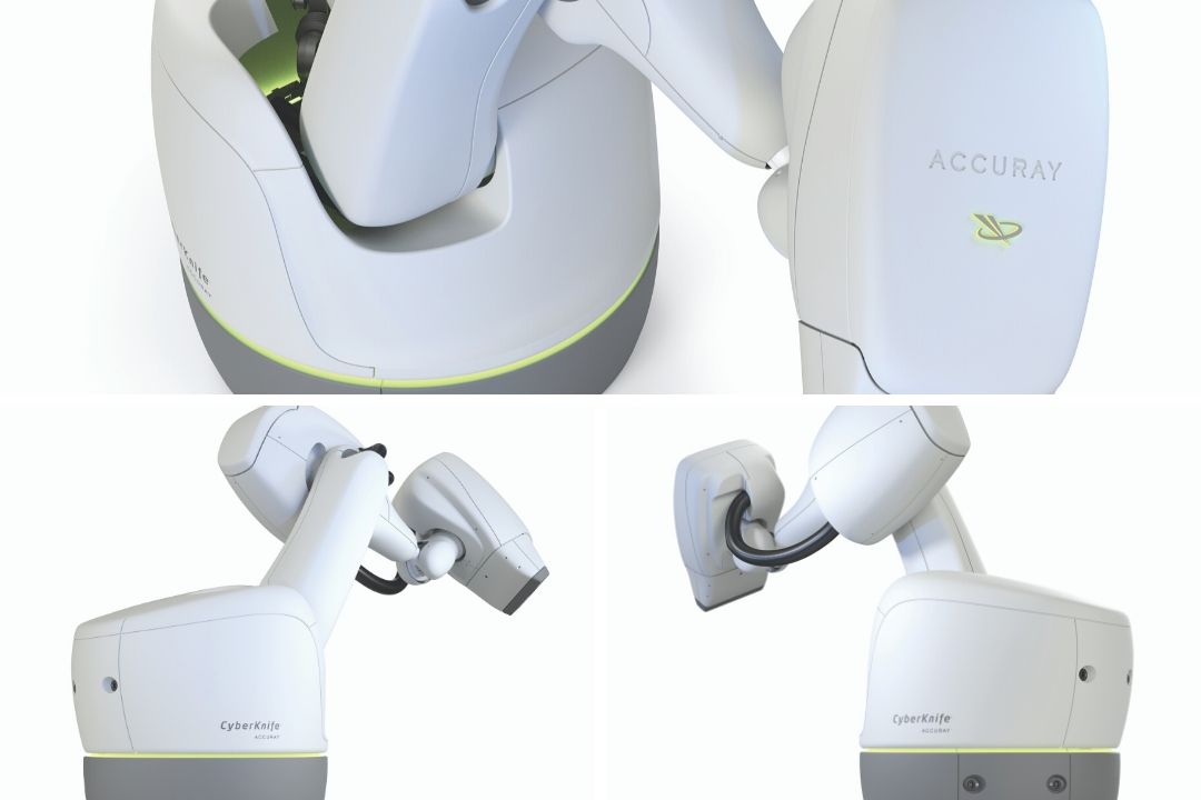 CyberKnife Accuray machine cyberknife miami - alternative cancer treatment - cancer treatment in south florida
