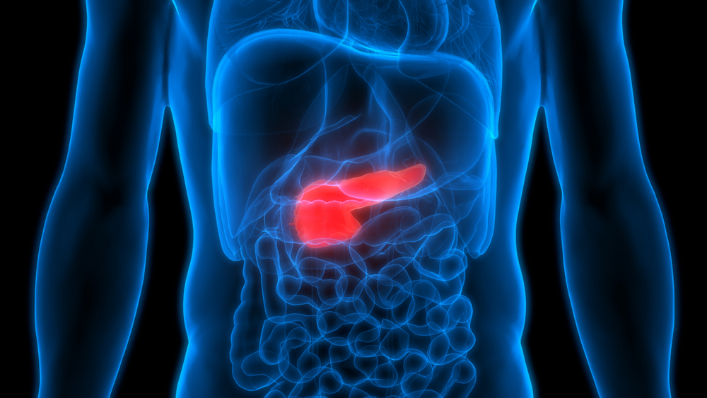 What Are Effective Treatments for Pancreatic Cancer?