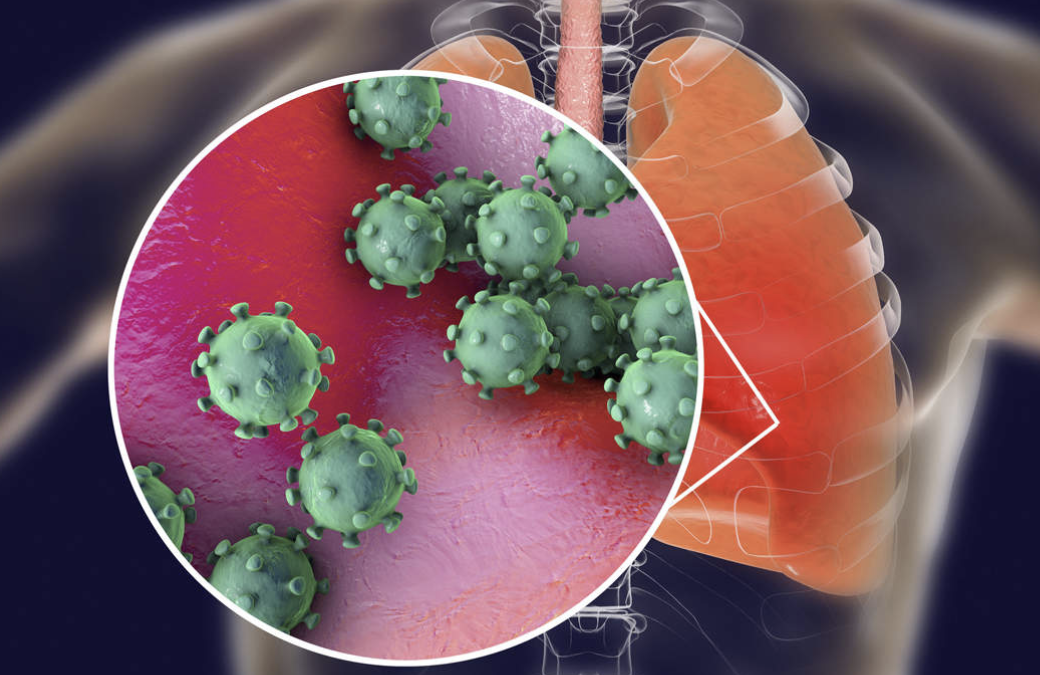 COVID-19 Concerns Are Interrupting Cancer Treatment