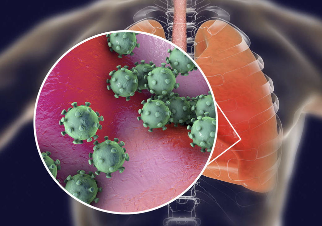 Covid19 pandemic - covid19 treatment - how to treat coronavirus - possible treatments for coronavirus