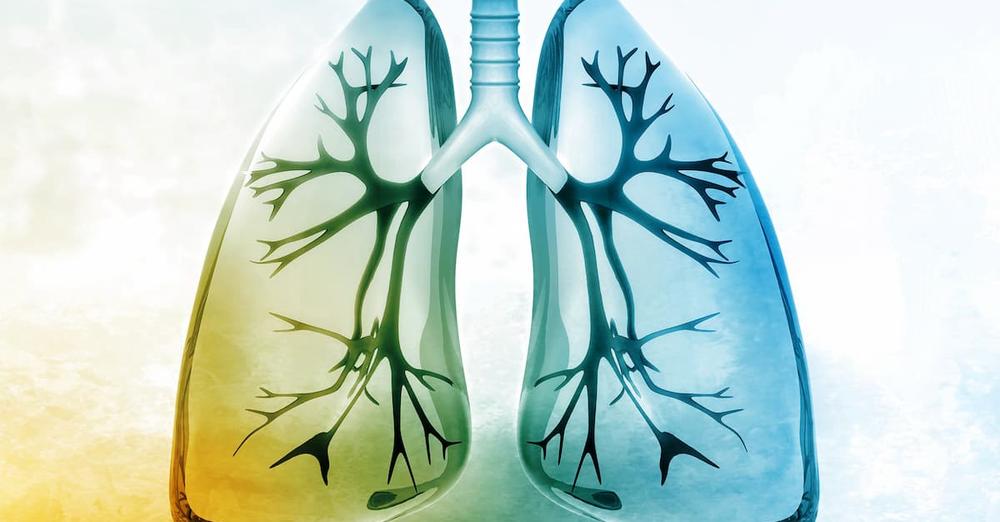 CyberKnife: A More Efficient Way to Treat Pulmonary Oligometastases