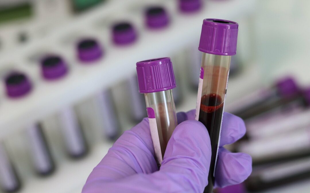 New Blood Test Can Identify if a Patient Has Cancer and If it Has Spread