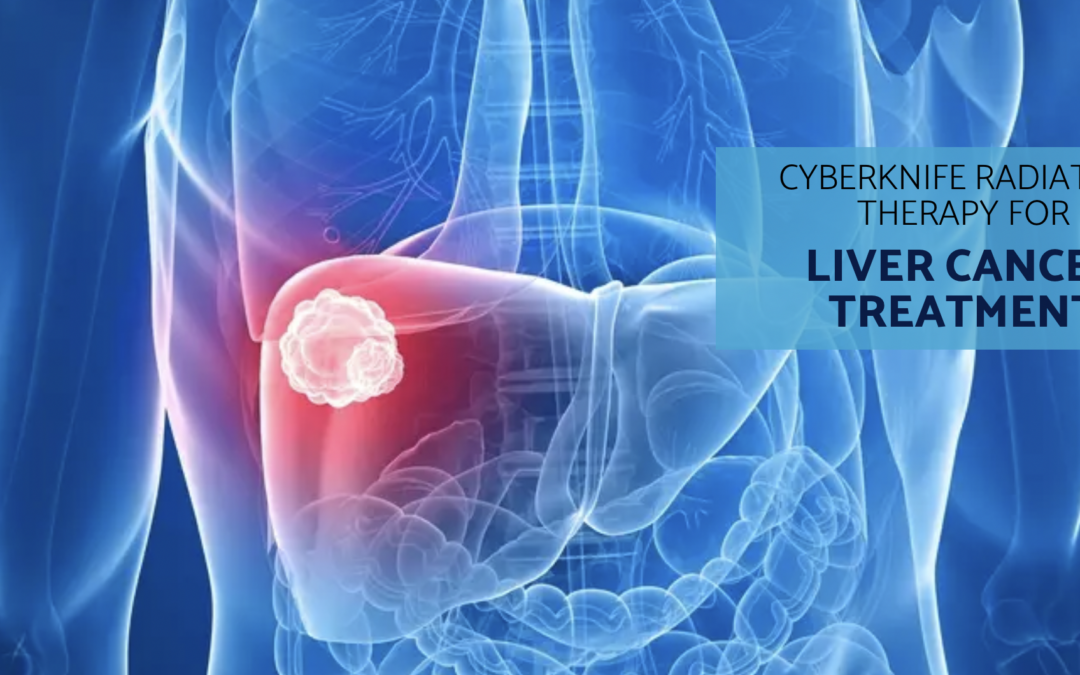 CyberKnife vs. Surgery For Liver Cancer Treatment