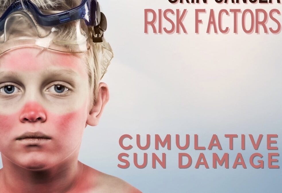 4th of July Sun Safety Reminders for a Lifetime