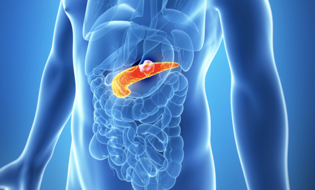 Two New Symptoms Could Detect Pancreatic Cancer Earlier And Save Lives